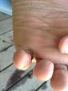Toe fish